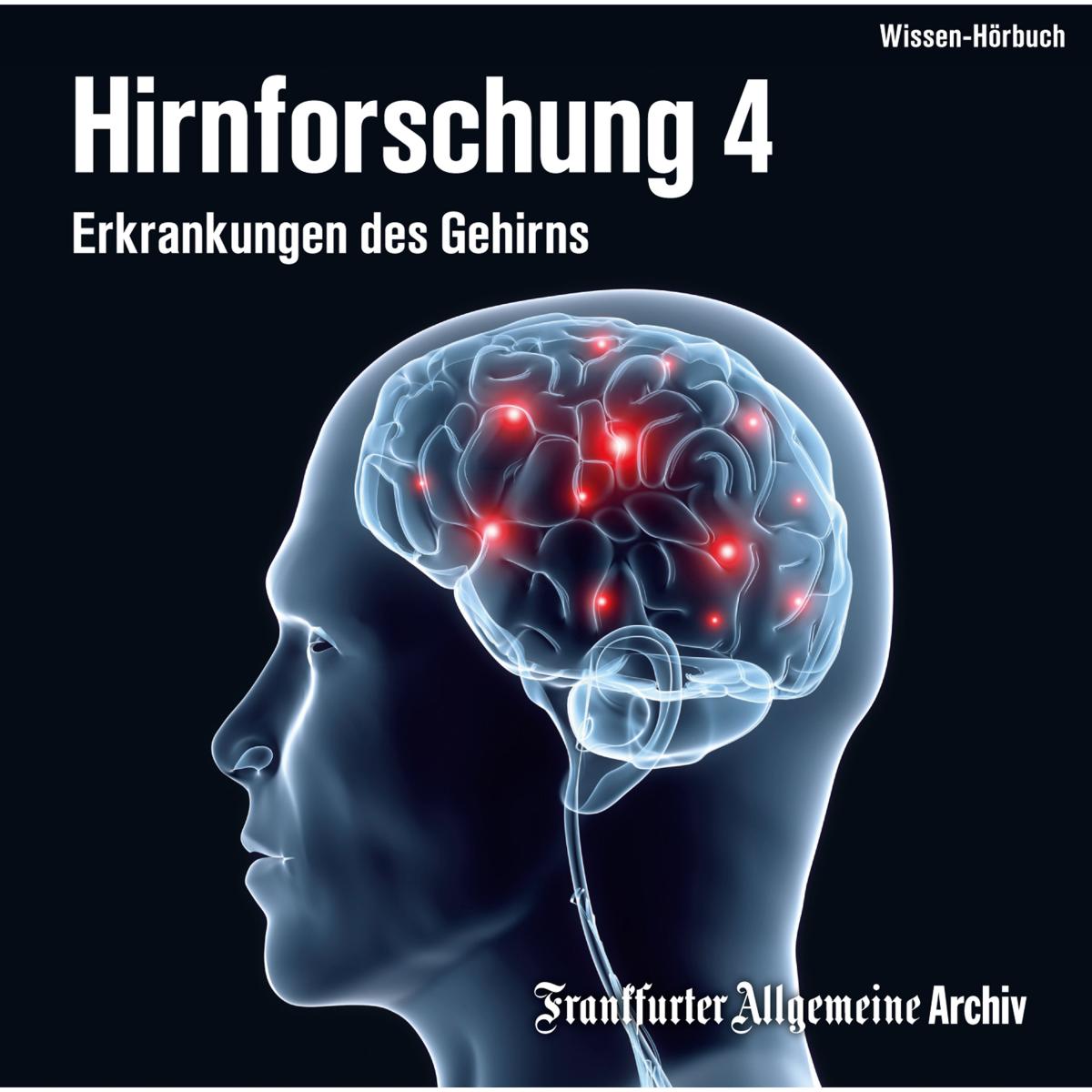 Hirnforschung 4