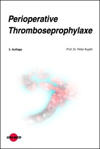 Perioperative Thromboseprophylaxe