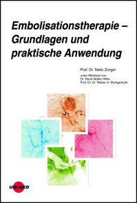 Embolisationstherapie - Grundlagen und praktische Anwendung