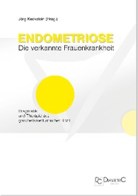 Endometriose - Die verkannte Frauenkrankheit