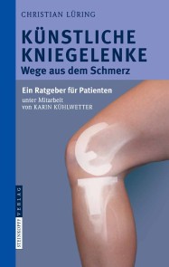 Künstliche Kniegelenke