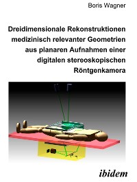 Dreidimensionale Rekonstruktionen medizinisch relevanter Geometrien aus planaren Aufnahmen einer digitalen stereoskopischen Röntgenkamera